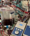 En perfusionist har ansvaret for hjerte-lunge-maskinen, som holder patientens kredsløb og iltning i gang under åben hjertekirurgi.